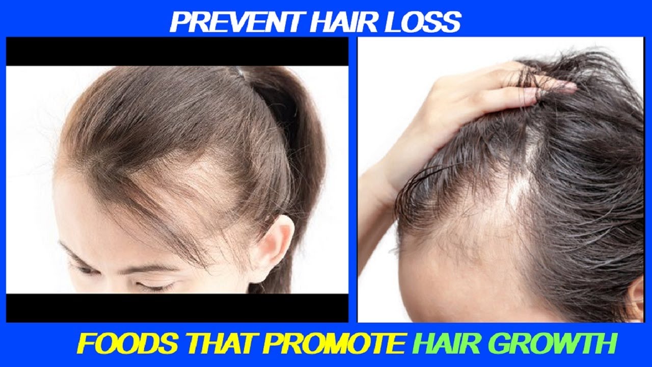 16 Vs 36 Pin For Hair Loss 5 FOODS FOR HAIR LOSS//PROMOTE HAIR GROWTH - YouTube