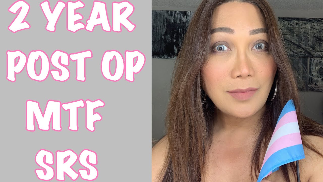 2 YEAR POST OP MTF SEX REASSIGNMENT SURGERY ( SRS ) YouTube