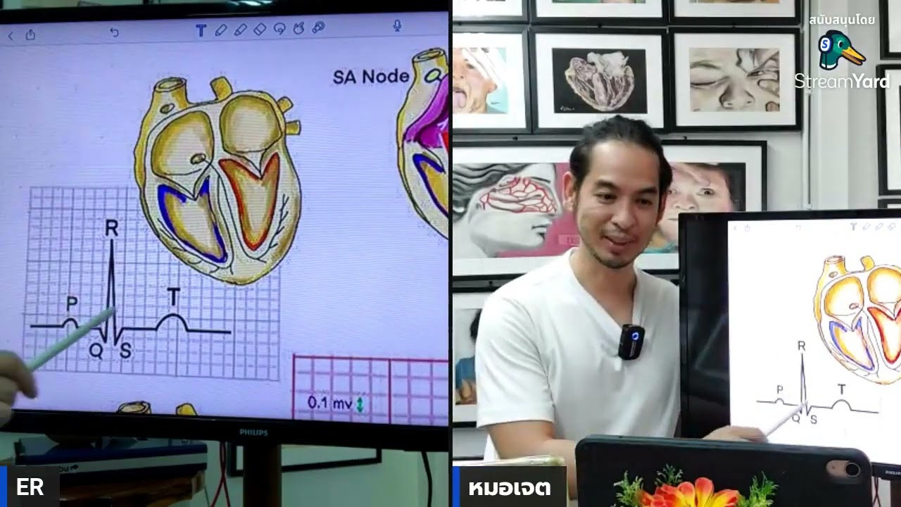 ตอนที่หนึ่ง: สุดยอดการอ่านคลื่นหัวใจEKGตั้งแต่เคยทำมา เบสิคEKG