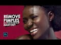 How to REMOVE Pimples in Photoshop SIMPLE and EASY || Photoshop tutorial