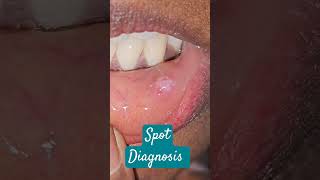 Spot Diagnosis Skin Mucosa imwell Musosa