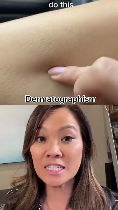 This is a condition called.... #shorts #drpimplepopper #drsandralee