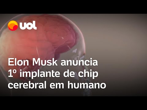 Elon Musk anuncia 1º implante de chip cerebral da Neuralink em ser humano