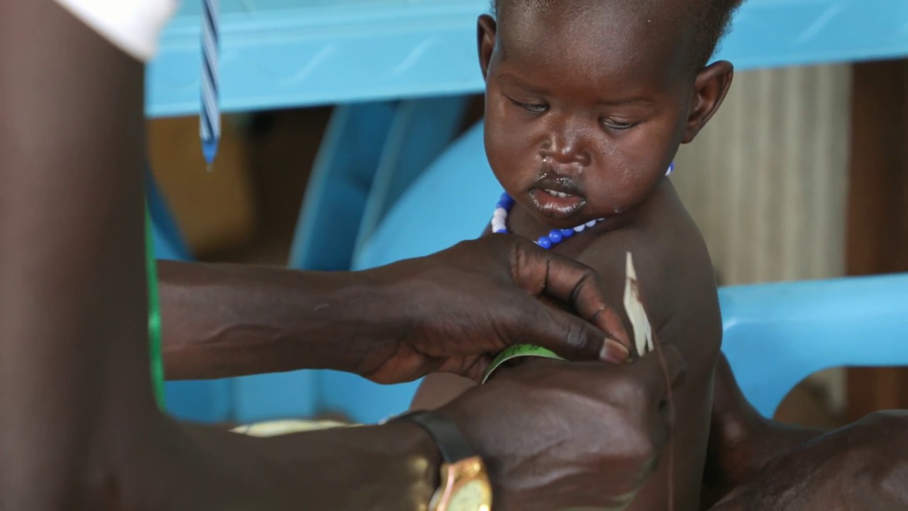Health & nutrition issues in South Sudan | Concern Worldwide