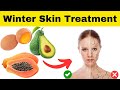 Upcoming Winter Skin Treatment at Home