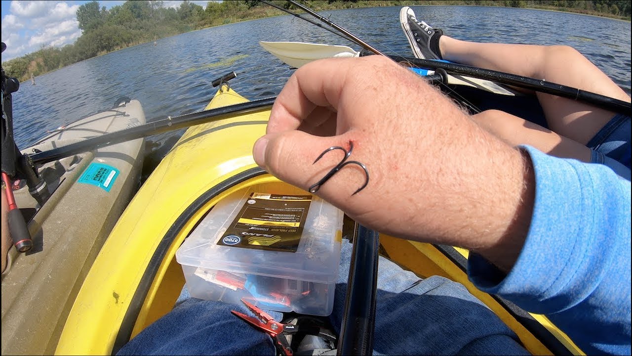 How to PAINLESSLY Remove a Fishing Hook from HAND!!! YouTube