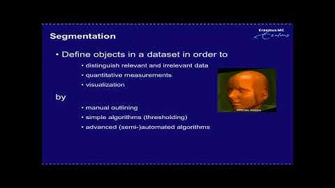 Image Segmentation: Methodolgy and Validation