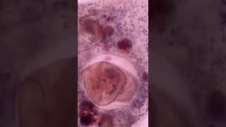 Paramecia tumble in amoeba food vacuole #shorts