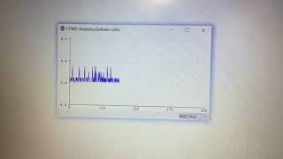 Vehicle Driver Drowsiness detection using ECG signal