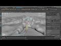 3d medical tutorial Placing blood vessels on the tumor