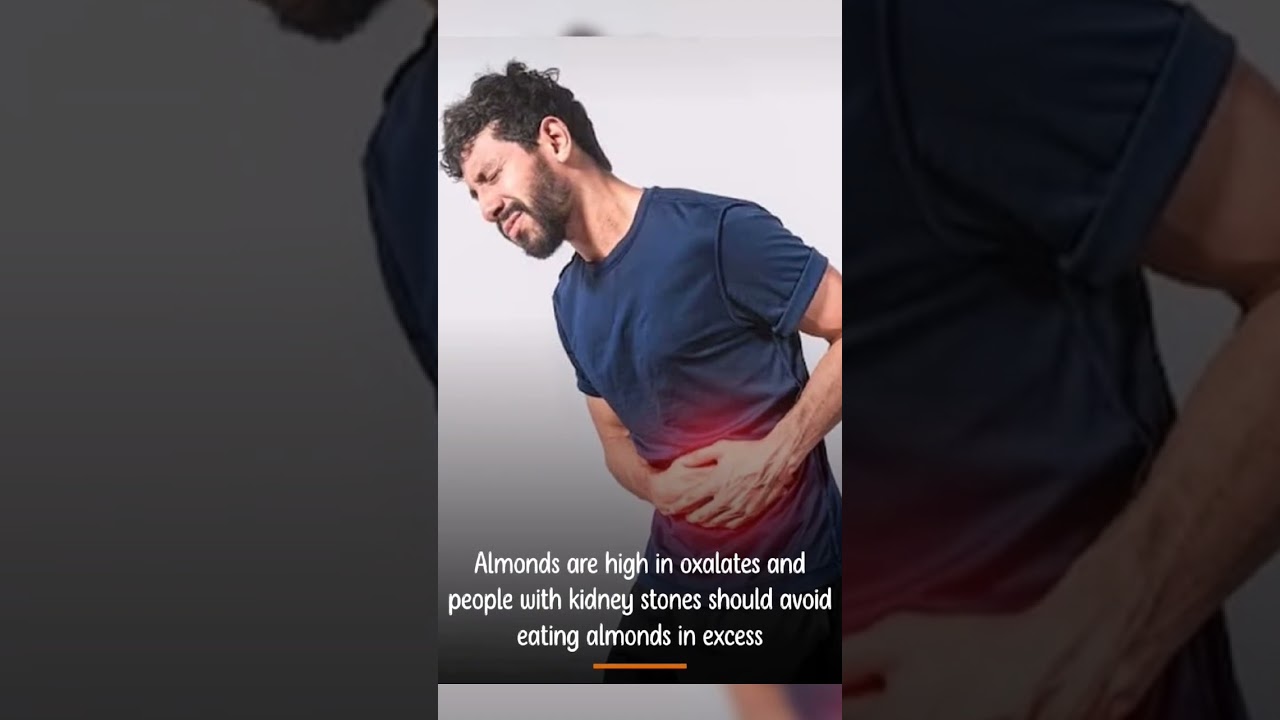 8 Disadvantages of Eating Too Much Almonds