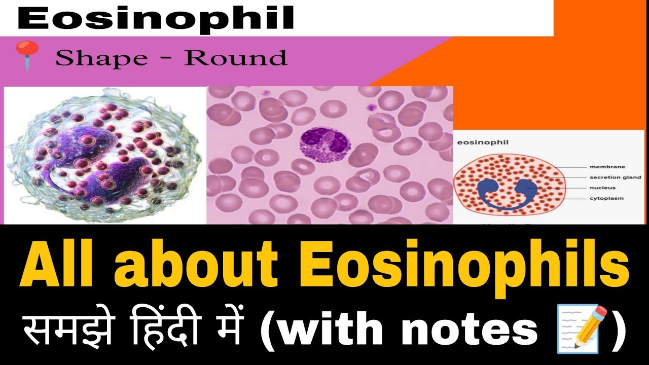 Eosinophil All about eosinophil Eosinophils in hindi Esinophil notes ph patho hub