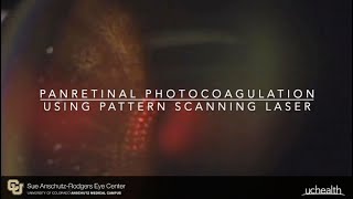 Pascal PRP for PDR