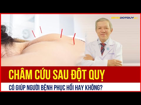 Video Châm Cứu Sau Đột Quỵ Có Giúp Người Bệnh Phục Hồi Hay... - youtube