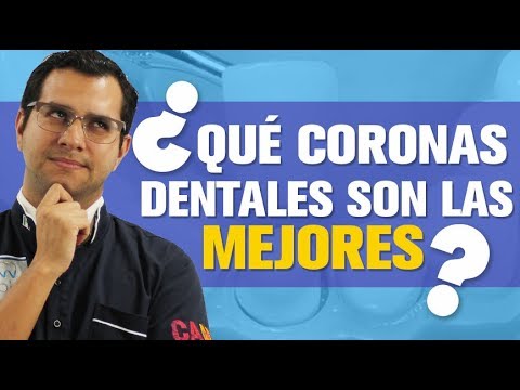 Vídeo: Chapas Vs. Coronas: ¿Cuáles Son Los Pros Y Los Contras De Cada Uno?