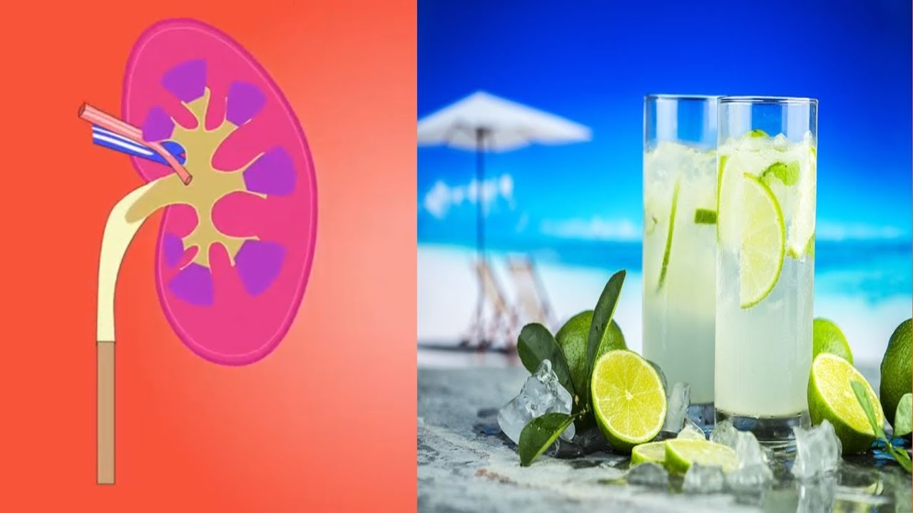 Lemon juice for kidney stones best remedy for kidney stones how to