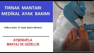 Mantar ve Kopan Tırnağım İçin Gülhan Şeker El Ayak Bakım Merkezine gittim