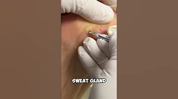 This Was In Her FOOT Shorts 