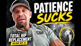 Total Hip Replacement Vlog Ep. 6 - Patience Sucks