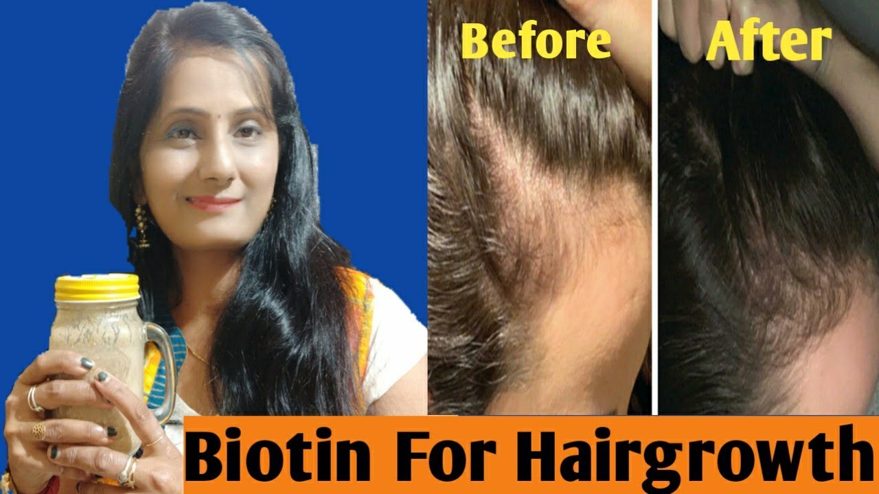 want to grow hair long fast|biotin supplement 4 hair biotin 4 hair