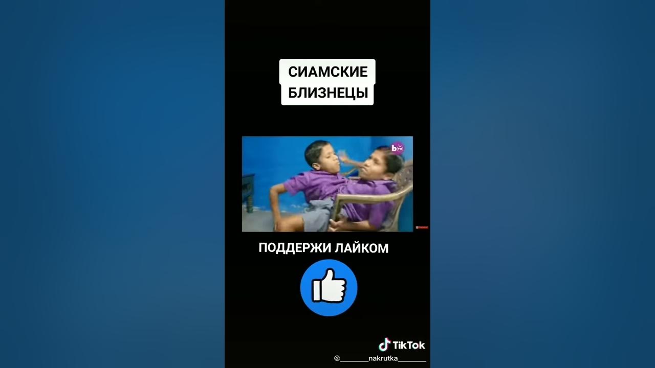 Сеамские близнецы - YouTube