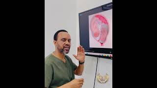 Ufanye nini ukiwa una mimba ya mapacha na mmoja kafia tumboni? #twins #viral #pregnant