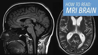 How to Read a Brain MRI: Basic Search Pattern & Sequences Explained