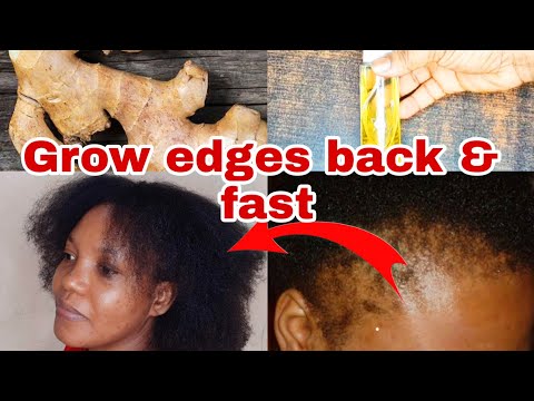 DIY GINGER OIL| REVERSE THINNING HAIR & SAY GOODBYE TO DANDRUFF