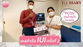 อาจเป็นเพราะอสุจิไม่แข็งแรง!! &PCOS!! ก็เป็นได้? | IUI Diary