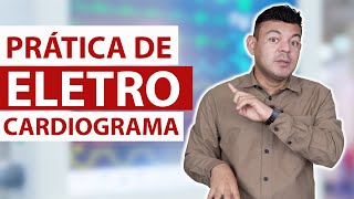 Do you know how to perform an ECG? [electrocardiogram]