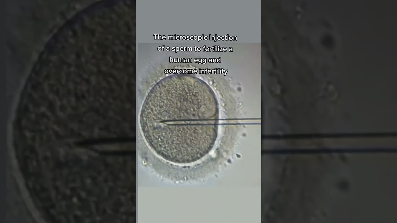 the red circle shows the sperm we are injecting with a glass needle