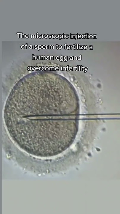 the red circle shows the sperm we are injecting with a glass needle