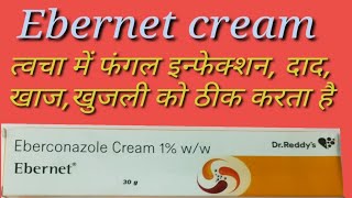 Ebernet Cream Composition,Uses,Side Effects..