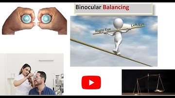Mastering in Binocular Balancing by Alternate occlusion test