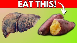 Do These Method To DETOX your FATTY Liver without medication? | Fatty Liver Treatment #fattyliver