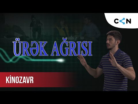 Kinozavr #57 | Ürək ağrısı