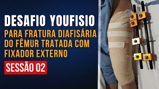 DESAFIO YOUFISIO PARA FRATURA DIAFISÁRIA DO FÊMUR TRATADA COM FIXADOR EXTERNO - SESSÃO 02