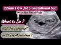 22mm 6w 5d Gestational Sac with no Fetal pole is This Missed Abortion Miscarriage