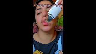 Steam Cleaning And Peeling Same Clinics Shorouk Waslawo Islawo Viralvideo Skincare Fory 