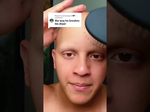 They like my h(air) 🫣 #comedy #funny #alopecia
