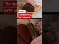 Download Lagu Läkaren varnar för populära husmanskosten: ”Proteinerna är värdelösa”