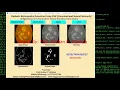Diabetic Retinopathy Identification In Fundus Image Using CNN Python Project With Source Code