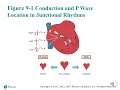 Chapter 9 Rhythms Originating in the AV Junction lecture part I
