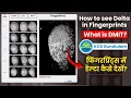 How to see Delta in Fingerprints what is DMIT