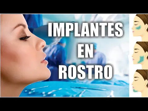 Download MP3 TIPOS DE IMPLANTES en el ROSTRO 🥰 CIRUGÍA FACIAL en MENTÓN Y PÓMULOS ⭐ Dr ALBERTO CALVO QUIROZ