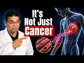 Cancer Cachexia Mechanism Explained Why Cancer Causes Severe Weight Muscle Loss