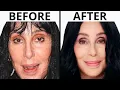 Cher s NEW FACE Plastic Surgery Analysis