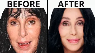 Cher s NEW FACE Plastic Surgery Analysis