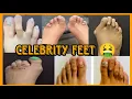 WHY CELEBRITIES ARE REVEALING THEIR UGLY FEET