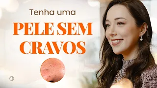 como tirar os cravos da sua pele cravos no rosto o que o que fazer para evitar e como tratar